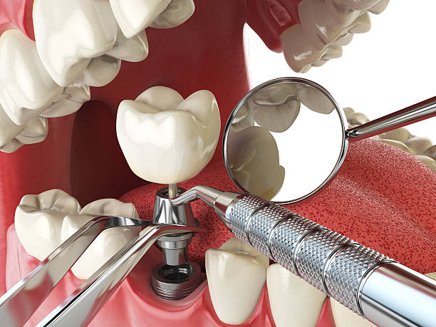 Best Emergency Care for Gum Disease in Hastings, MI